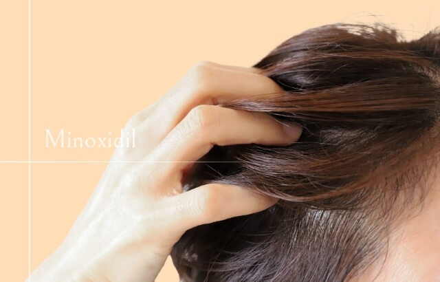 ミノキシジル(外用・15%)